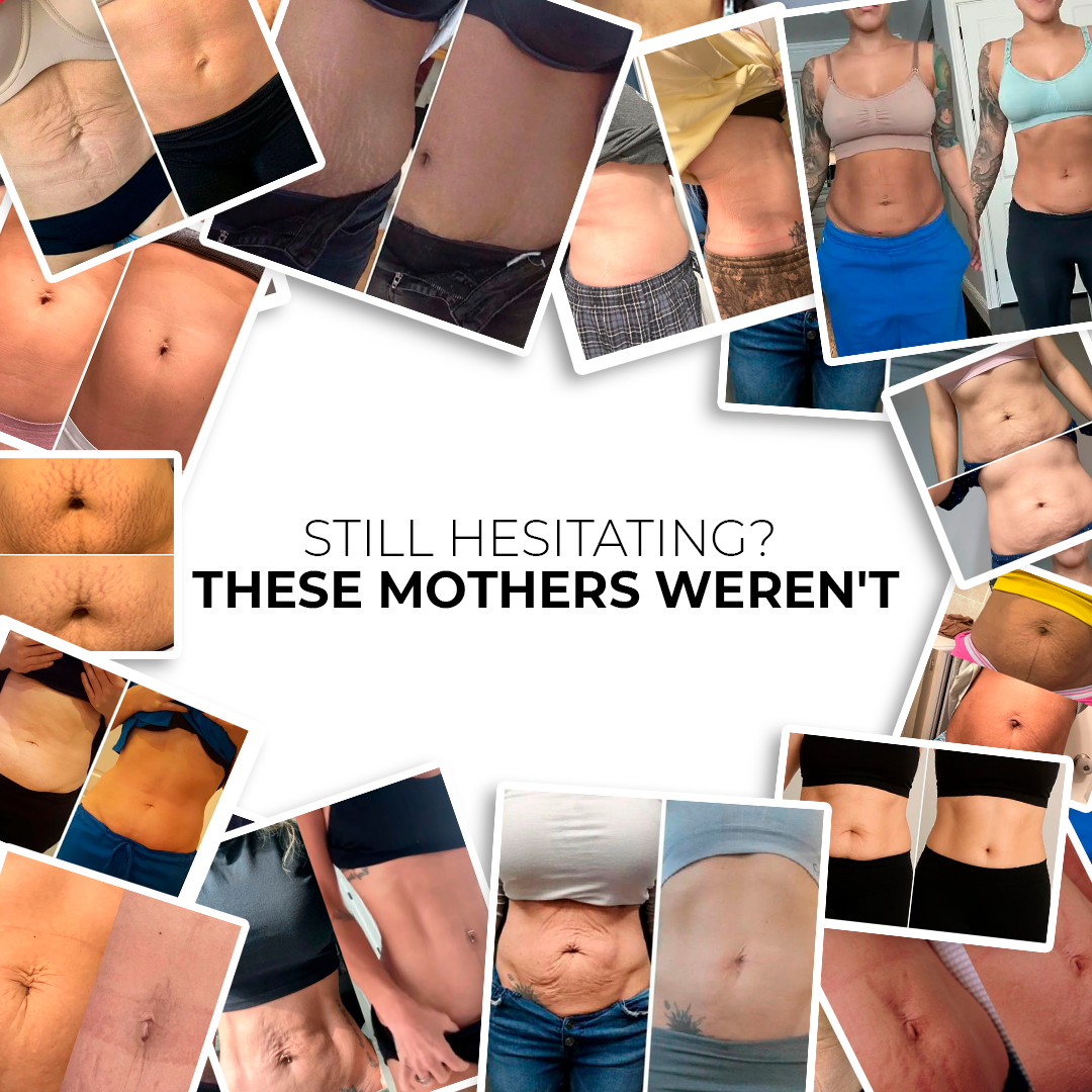 Sculpté ReGlow Kit™